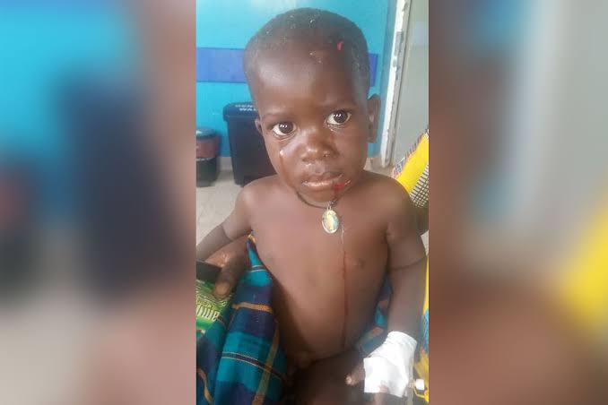 Ugandan toddler swallowed by a Hippopotamus Survives After being spat out   