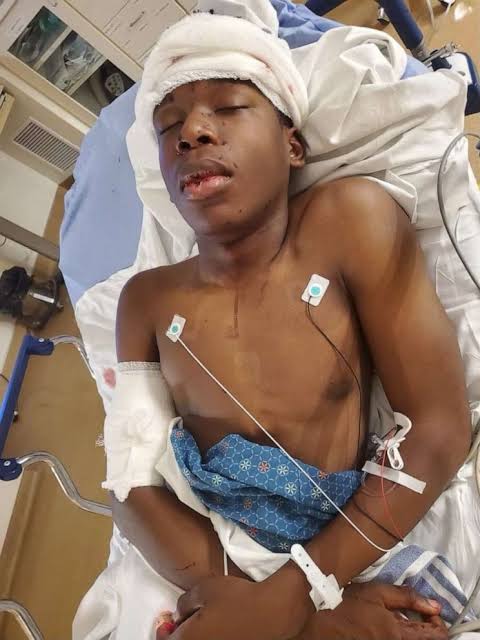 16-Year-Old Ralph Yarl, Recovering After Being Shot For Going To The Wrong House To Pick Up Siblings 