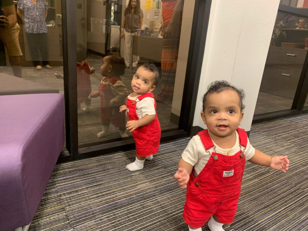 Formerly Conjoined Twins JamieLynn and AmieLynn Celebrate 1st Birthday and Take  1st Steps After Successful Separation Surgery 